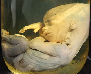 Human Embryo - About 4 1/2 - 5 Months