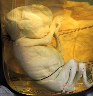 Human Embryo - About 4  Months