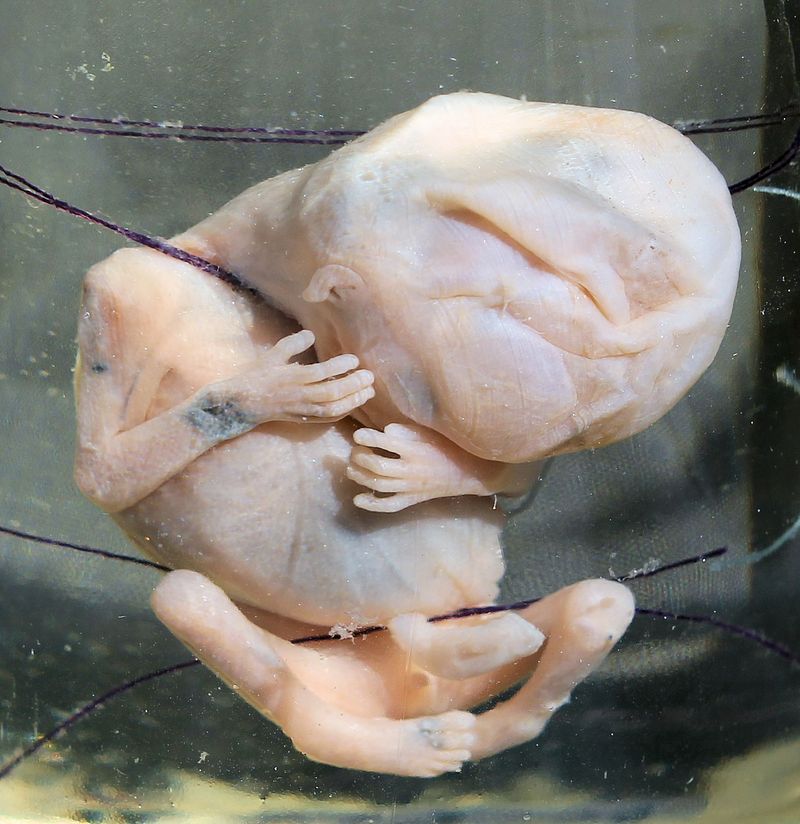 Human Embryo - About 2 1/2 - 3 months