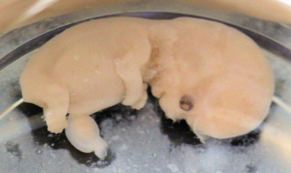 Human Embryo - About 2 months